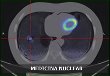 5 medicina nuclear menu 1